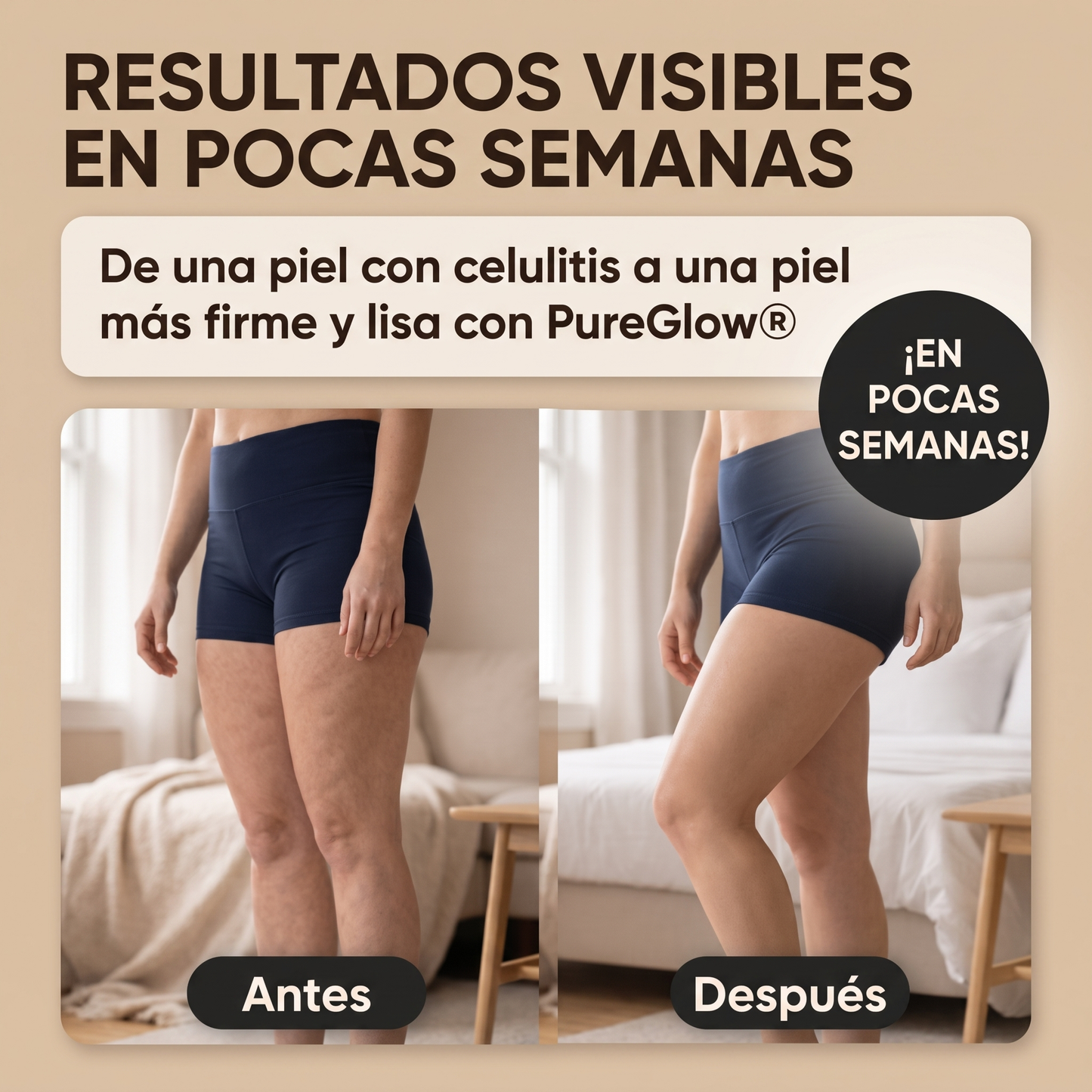 BodyRitual™ Masajeador Anticelulítico con Calor y Ventosa